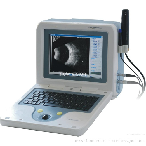 Ophthalmic Ultrasound a/B Scan